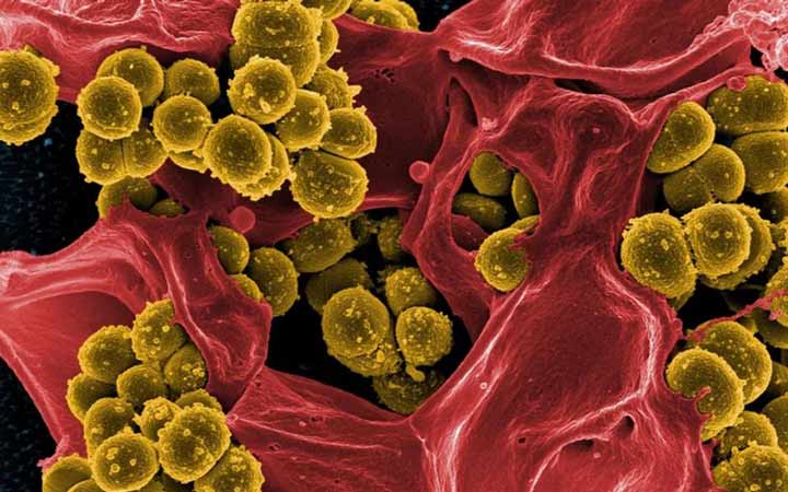 جهان در سال ۲۰۵۰ - باکتری‌های مقاوم دربرابر آنتی‌‌بیوتیک