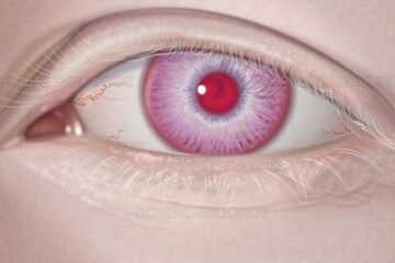 بیماری چشمی, چشم‌, سلامت چشم, سلامتی, صورتی, مجله سلامت, مراقبت از چشم