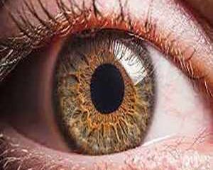 بیماری چشمی, چشم‌, سلامت چشم, مجله سلامت, مراقبت از چشم, مردمک